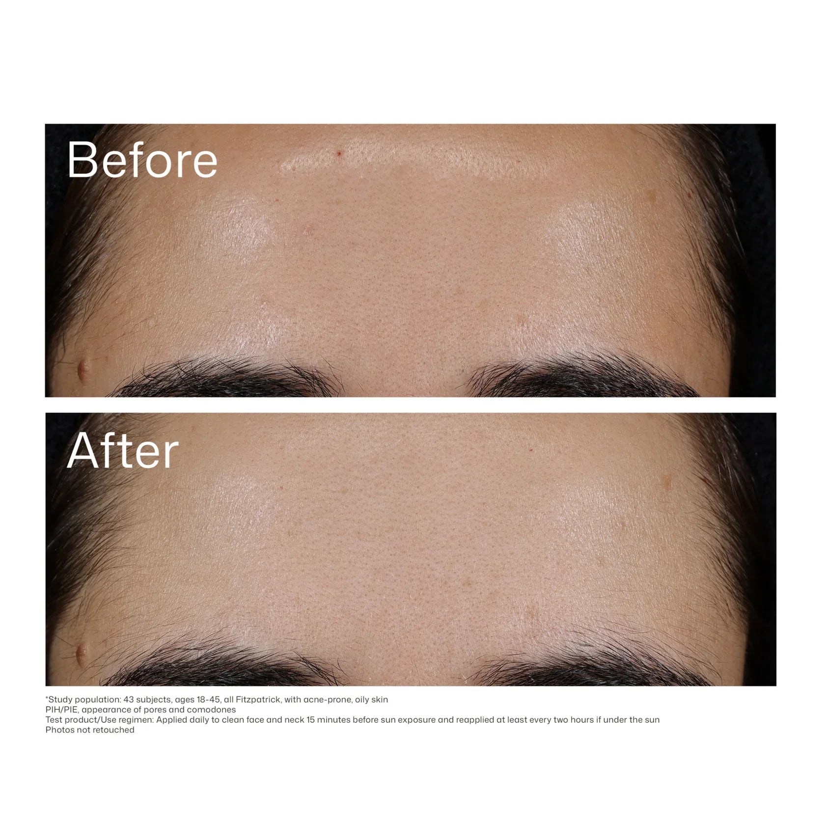 EltaMD® UV Clear Blemish-Prone & Oil Balancing SPF 50  - 1.7 fl. oz. / 48 g